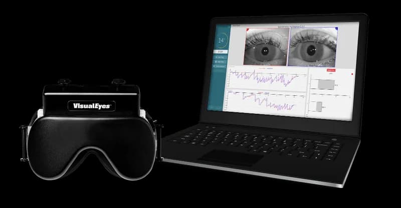 VNG testing equipment for vestibular analysis